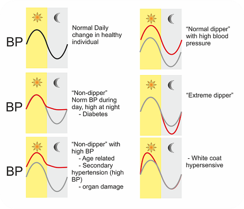 circadian blood pressure
