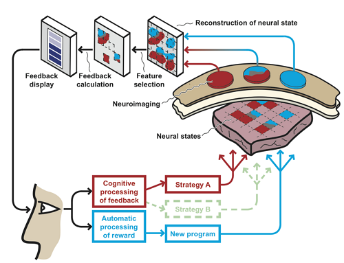 Neurofeedback